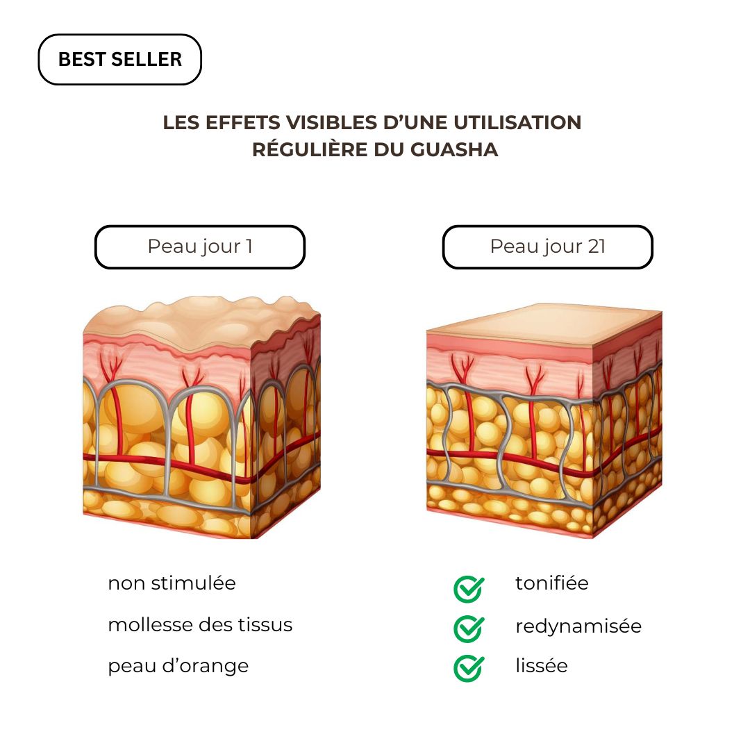 Ilustration des effets du gua sha sur la cellulite avec utilisation reguliere